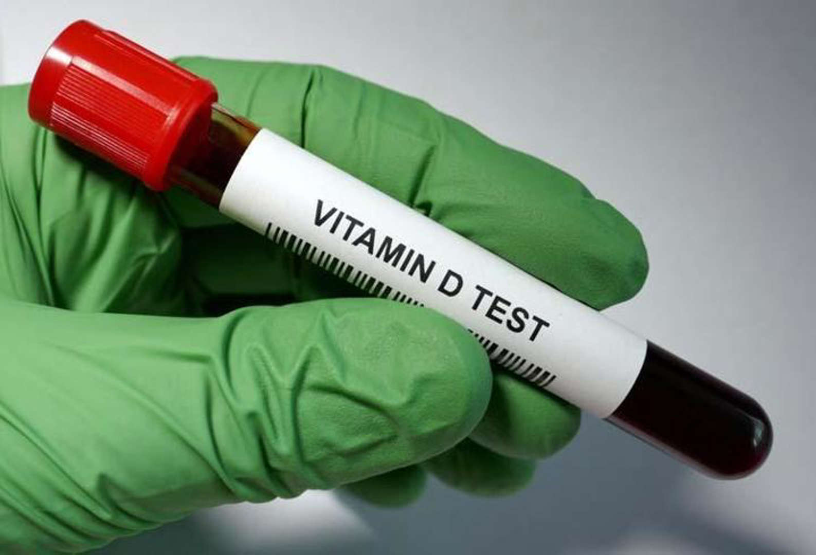 16 Yıllık Araştırmadan Çarpıcı Sonuç: D Vitamini Eksikliği Beyin Sağlığını Olumsuz Etkileyebilir - Görsel 3